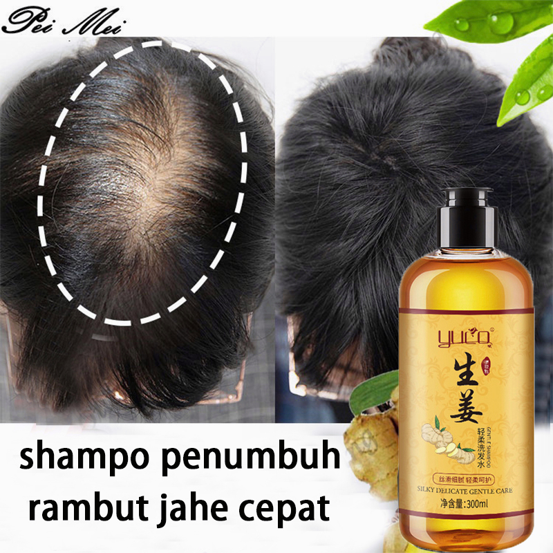 Jual 100 Asli Sampo Penumbuh Rambut Cepat Sampo Penumbuh Rambut 300ml Shampo Anti Ketombe 7504