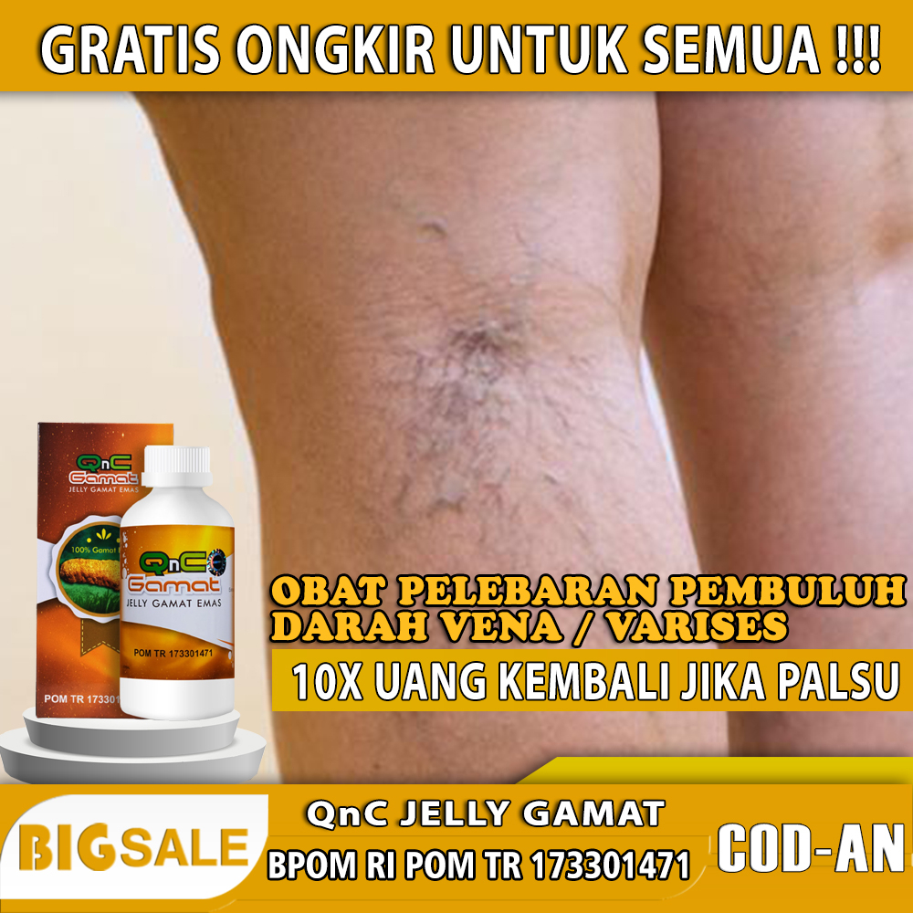 Jual obat pelebaran pembuluh darah vena / varises / trombofbitis