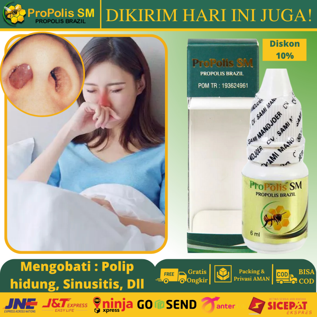 Jual Propolis Sm Herbal Tradisional Obat Untuk Hidung Sakit Nyeri, Obat