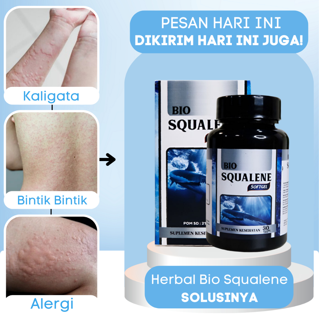 Jual Obat Kulit Gatal, Obat Gatal Gatal Alergi, Obat Gatal Biduran ...