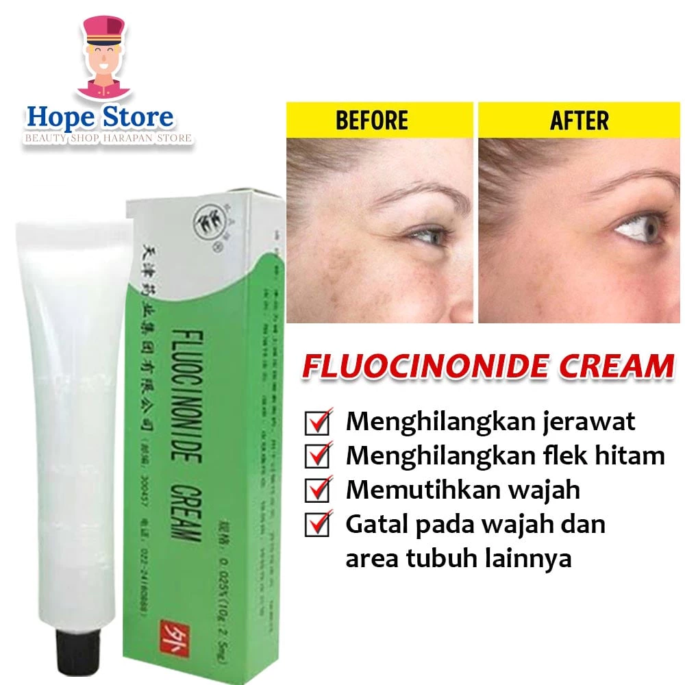 Hope Store - Salep Walet Lightening Cream Lightening Obat Gatal & Penghilang Flek Hitam Membandel Fluocinonide Cream | AutoStock