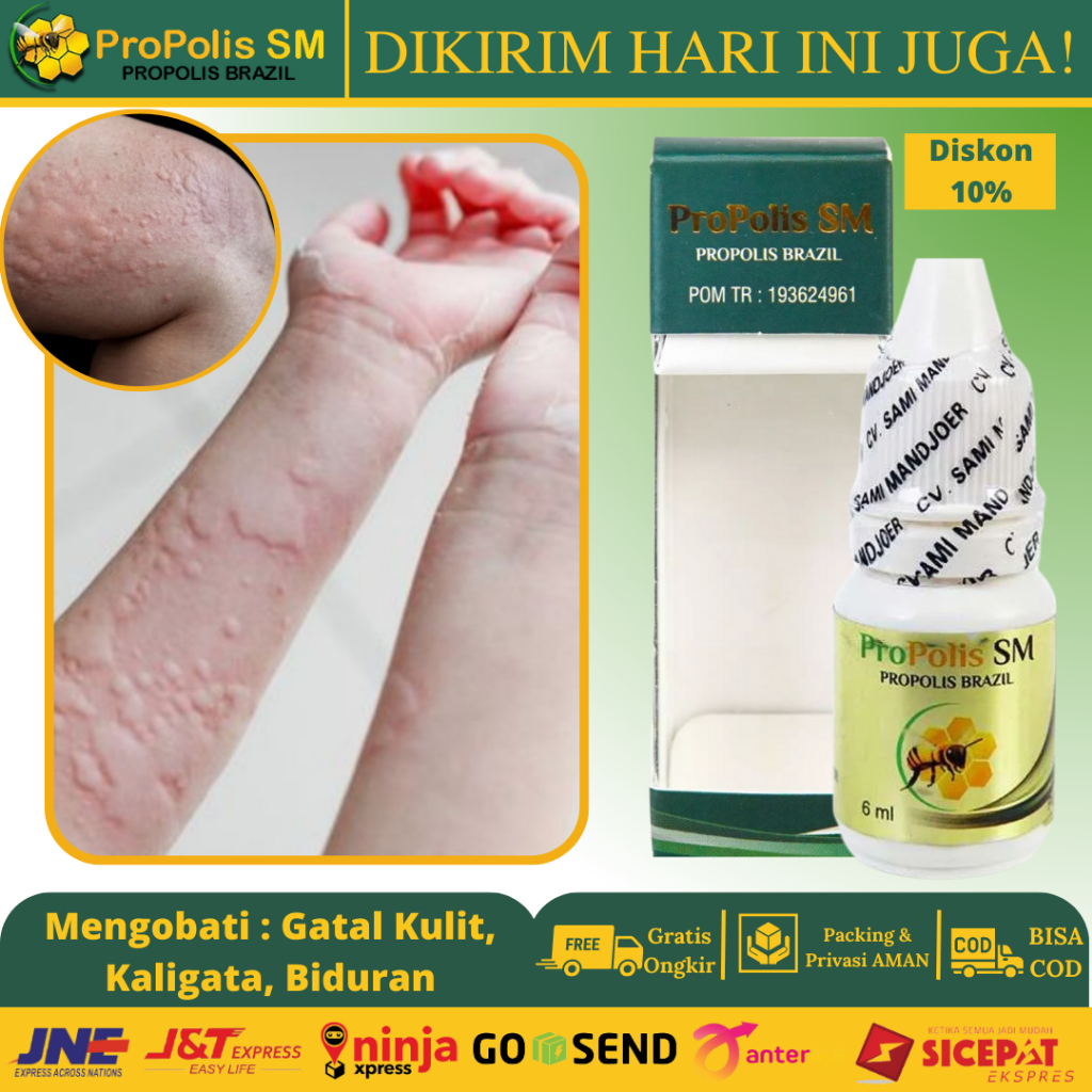 Jual Obat Biduran Gatal Kulit Obat Alergi Kaligata Akut Obat Kaligata Menahun Obat Gatal 0986