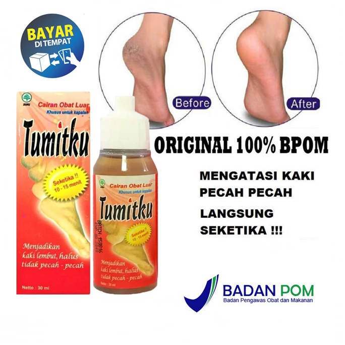 Mengatasi Tumit Pecah-pecah