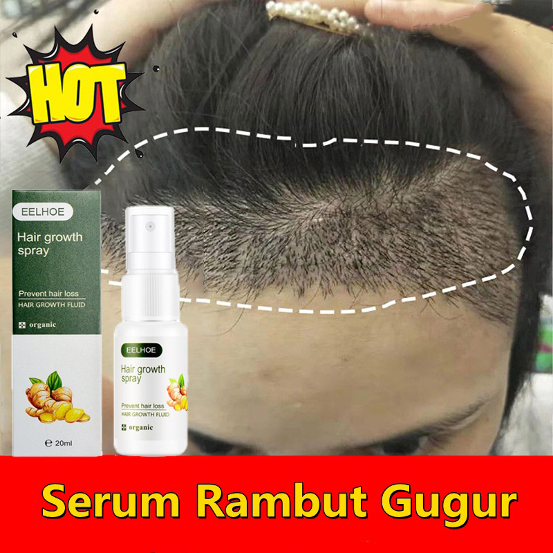 Jual Obat penumbuh rambut penumbuh rambut botak serum penumbuh rambut