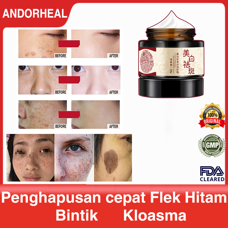 Jual Flek Hitam Penghilang Flek Hitam Cream Penghilang Flek Hitam Night