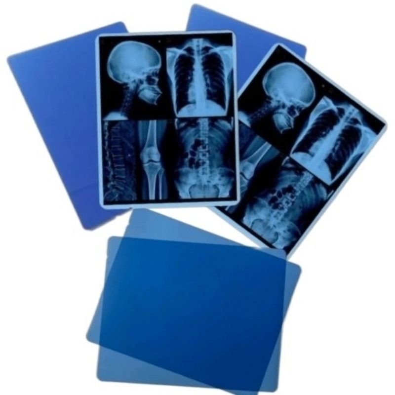 Jual Cetak Foto Image Medical Radiologi Rontgen X-ray CT-scan | Dry ...