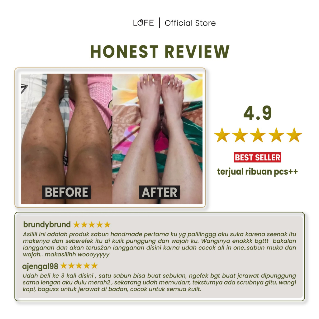 LOFE Miracle Coffee Soap - Sabun batang Organik Herbal by LOFE - Mengatasi Jerawat Wajah Tubuh Bekas Luka Stretchmark Lipatan Hitam Selulit - Weight 110GR