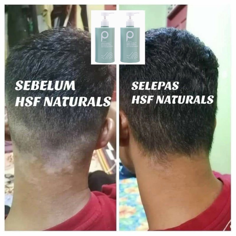 Jual shampoo anti ketombe anti dandruff shampoo Garam Laut Shampoo
