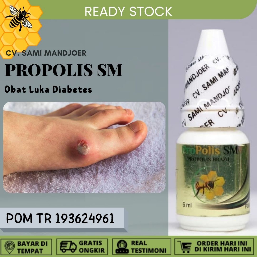 Jual Obat Luka Diabetes Luka Diabetes Basah Dan Kering Luka Diabetes