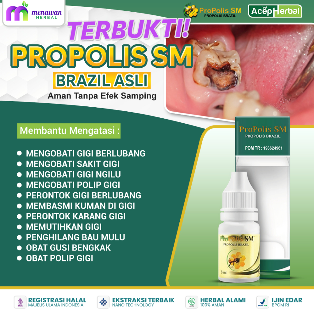 Jual Obat Sakit Gigi Berlubang Untuk Anak dan Dewasa Radang Gusi