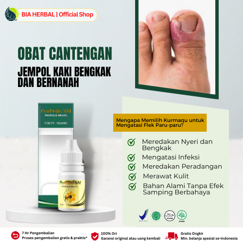 Jual Propolis Sm Obat Cantengan Dengan Formula Anti Inflamasi Dan