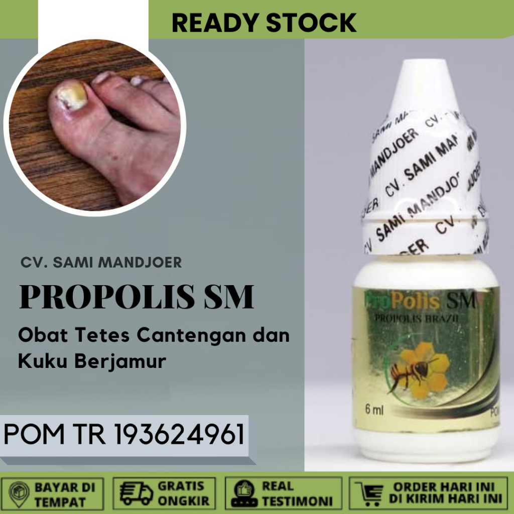 Jual Obat Cantengan Jempol Kaki Obat Cantengan Bengkak Dan Bernanah