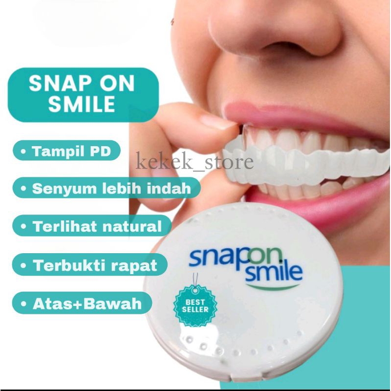 Jual Snap On Smile Veneer Gigi Palsu Instan Original Solusi Ompong ...