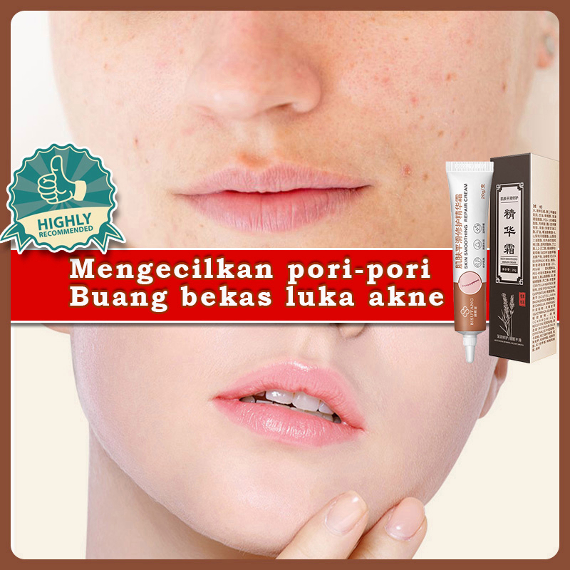 Jual Buang bekas luka akne Mengurangi pori dan menghapus freckles Kulit ...