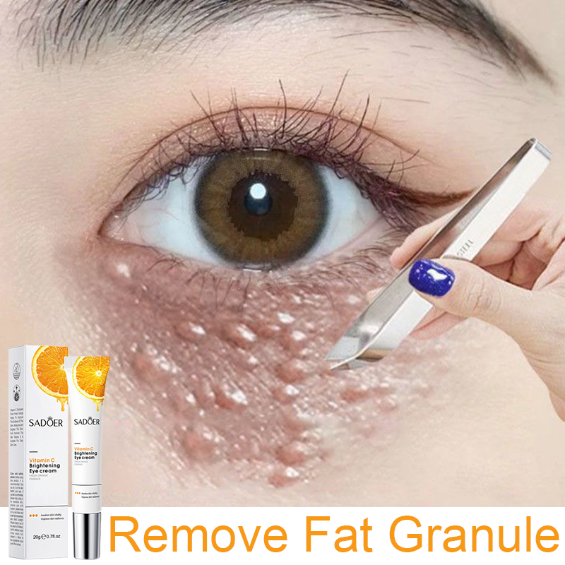 Jual Vitamin C Eye Cream Anti Aging menghilangkan milia menghilangkan