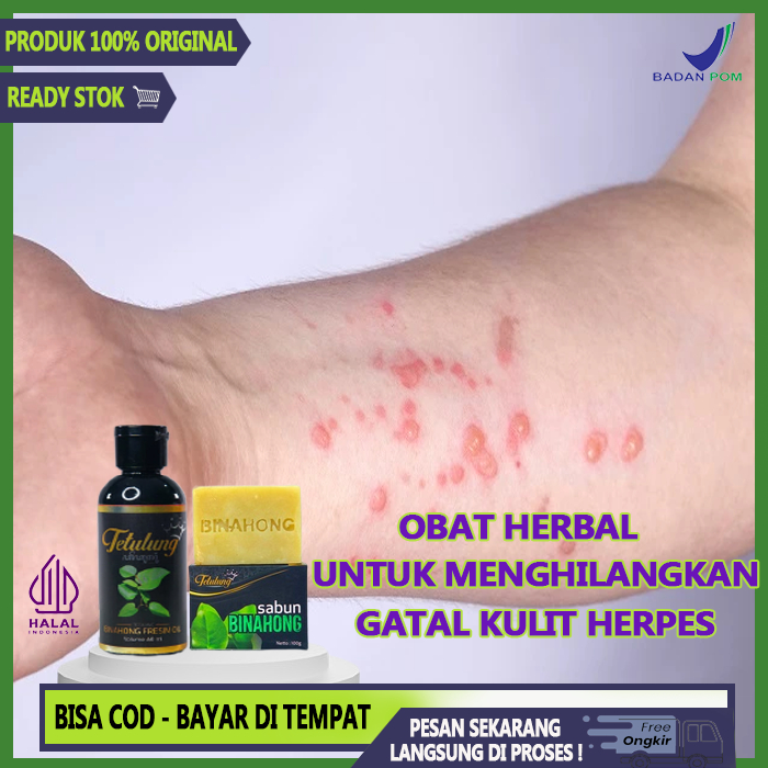 Jual Paket Tetulung Fresim Oil 60ml + Sabun Binahong Merupakan Obat