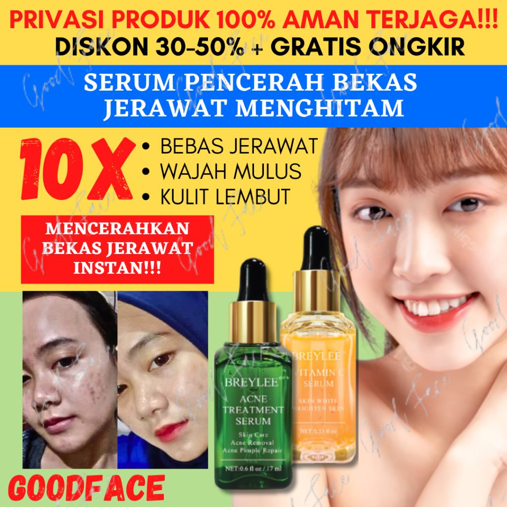 Serum Antijerawat Breylee: Ujian 7 Hari Pada Kulit Berminyak
