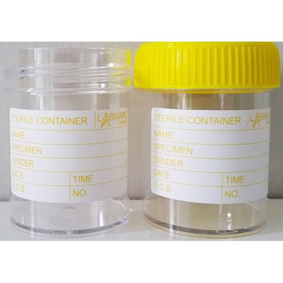 Jual Urine Container Urin Kontainer Steril 60 ml | Shopee Indonesia