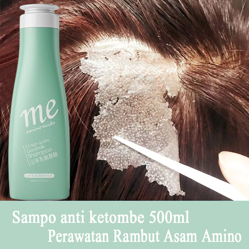 Jual Shampoo Anti Ketombe Sampo Anti Ketombe Obat Ketombe Berkerak Penghilang Ketombe Gatal 3315