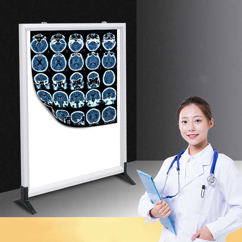 Jual X Ray Viewer Light Box X-Ray Lampu Baca Ronsen Rontgen Gigi ...