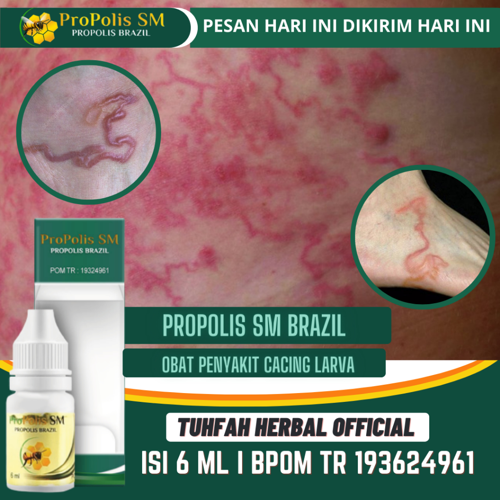 Jual Obat Cacing Larva Cacing Pasir Di Kulit Cacing Tambang Di Kulit Larva Cacing Pasir