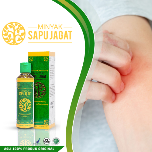 Jual Minyak Untuk Menghilang Gatal Pada Kulit Yang Tak Kunjung Sembuh