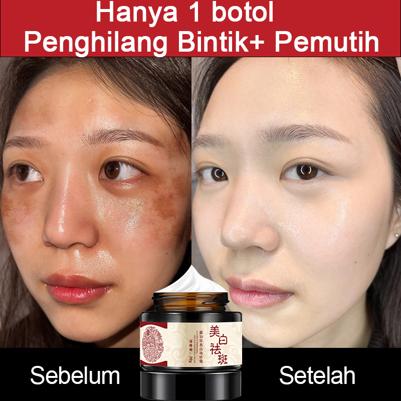 Jual Krim Penghilang Flek Hitam Cream Penghilang Flek Hitam Krim ...