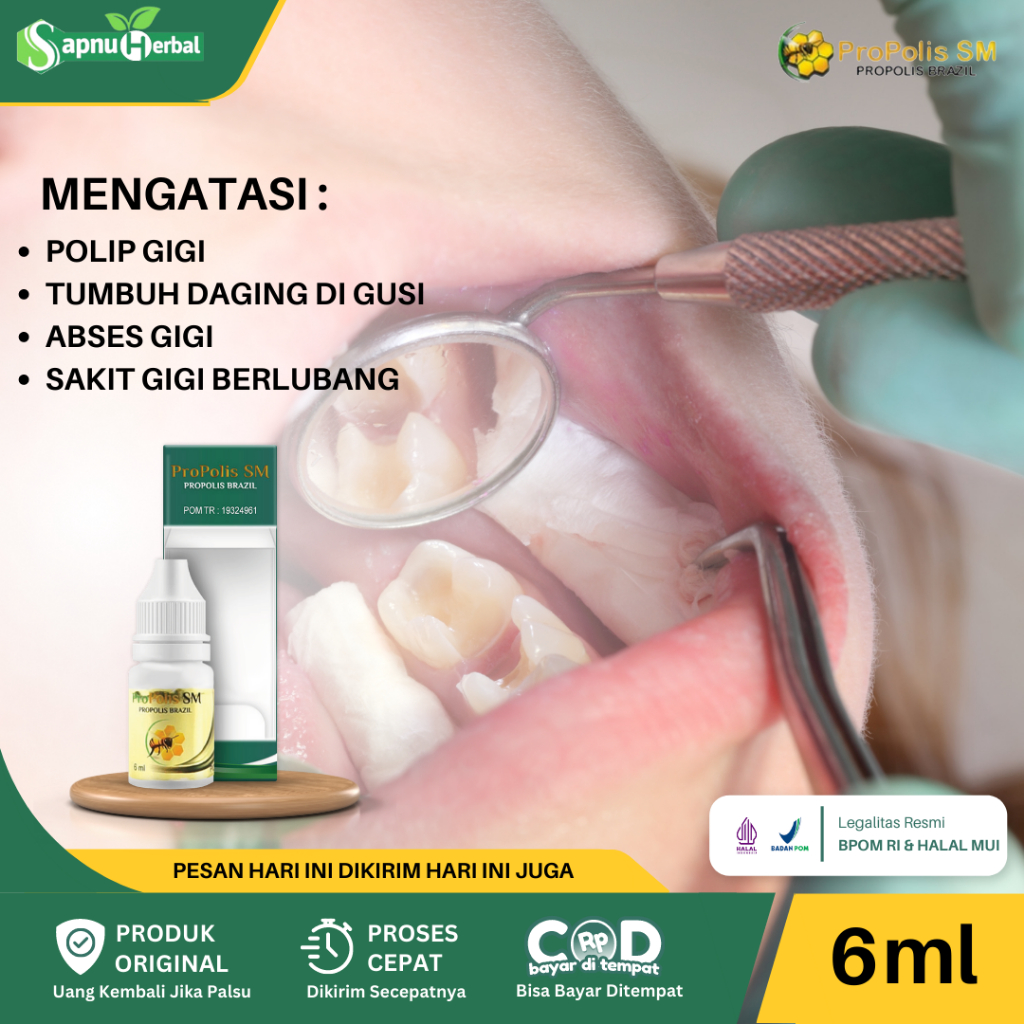 Jual Obat Polip Pulpa Gigi, Tumbuh Daging Di Gigi Berlubang / Gusi
