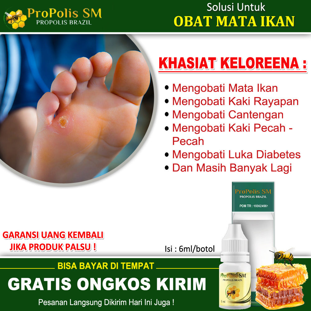 Jual Oba Mata Ikan Obat Tetes Kaki Rayapan Mata Ikan Di Kaki Tangan Kaki Pecah Pecah Luka