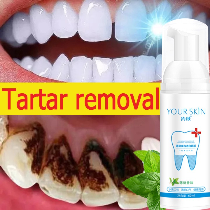 Jual Teeth Whitening Mousse Mouthwash Toothpaste Remove Tartar Oral
