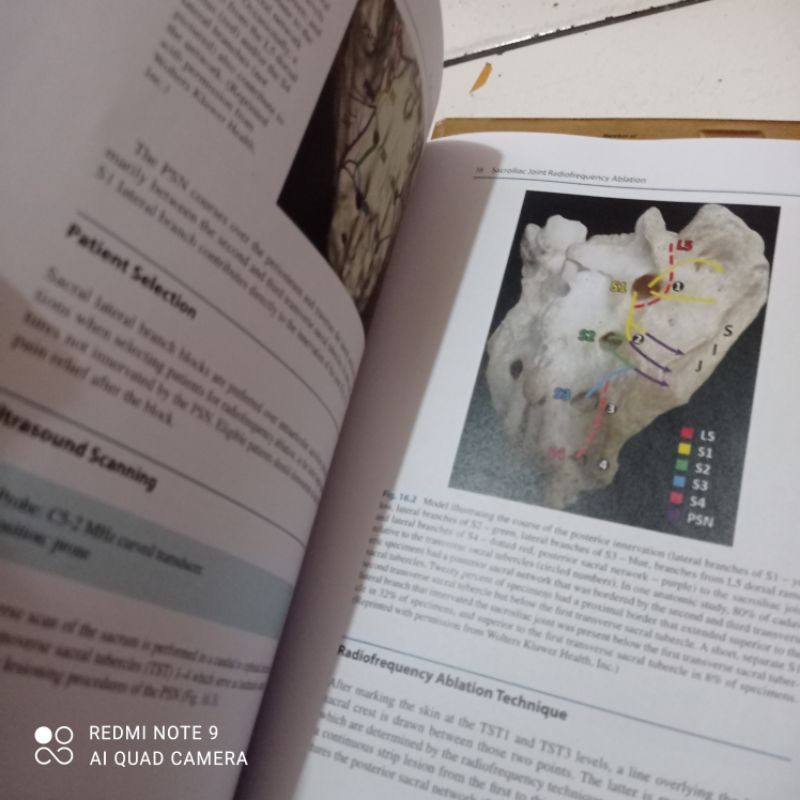 Jual Buku Hard Cover Ultrasound for Interventional Pain Managenent ...