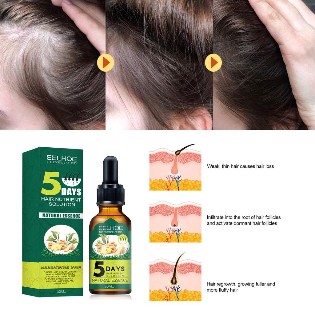 Jual EELHOE Hair Nutrient Solution Serum Jahe Penumbuh Rambut