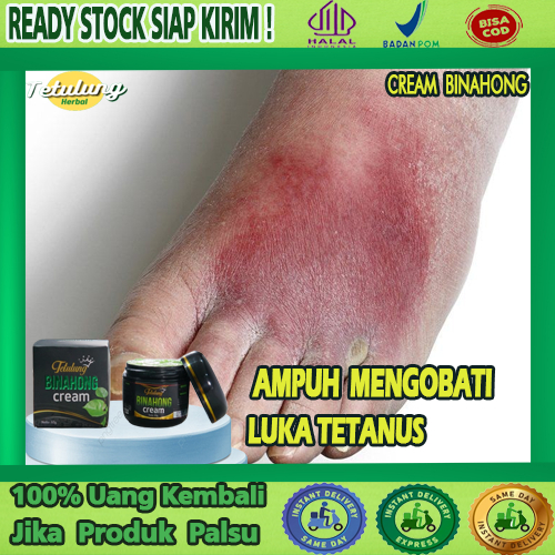 Jual Obat Herbal Luka Tetanus Ringan Kulit Terkena Paku Ditelapak Kaki Cream Binahong 60g 