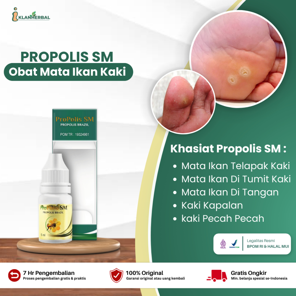 Jual Propolis Sm Obat Mata Ikan Telapak Kaki Obat Mata Ikan Di Kaki