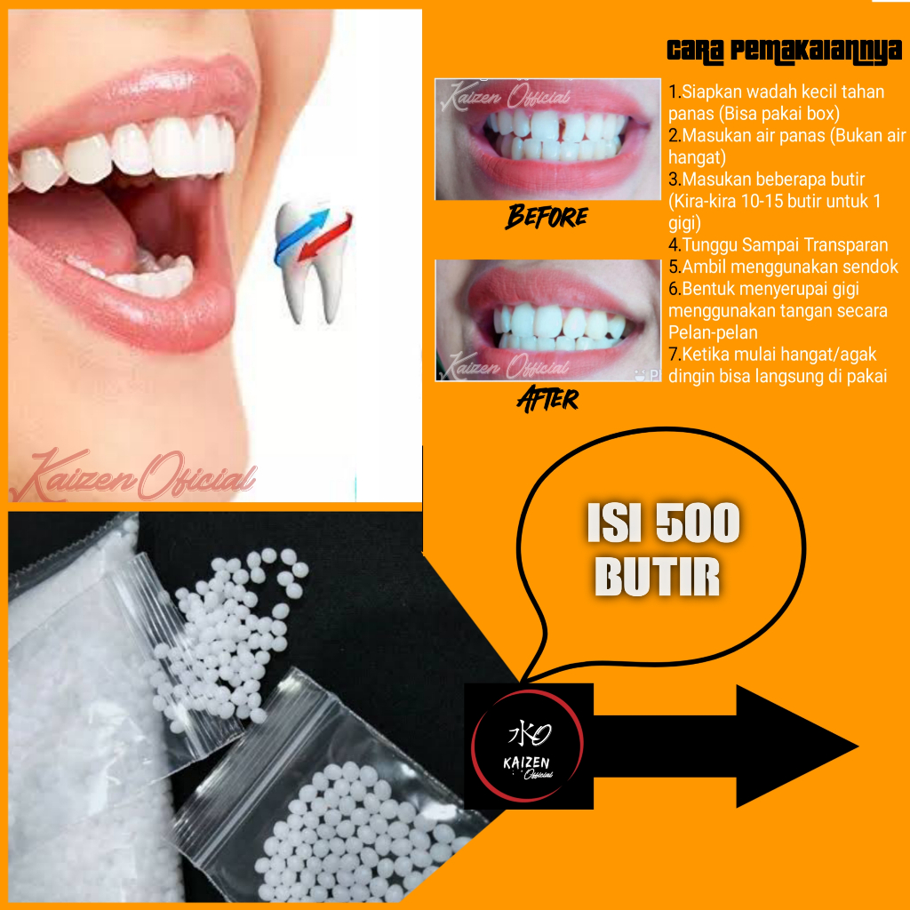 Jual Temptooth 500 Butir Penambal Gigi Bolong Gigi Patah Gigi Berlubang Shopee Indonesia 2300