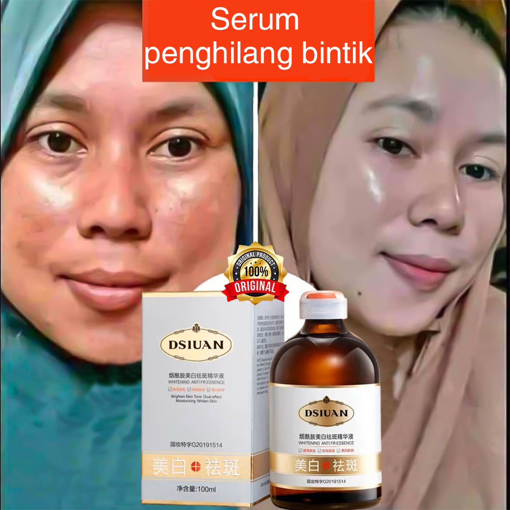 Jual Serum Flek Hitam Serum Flek Serum Penghilang Flek Hitam 100ml ...