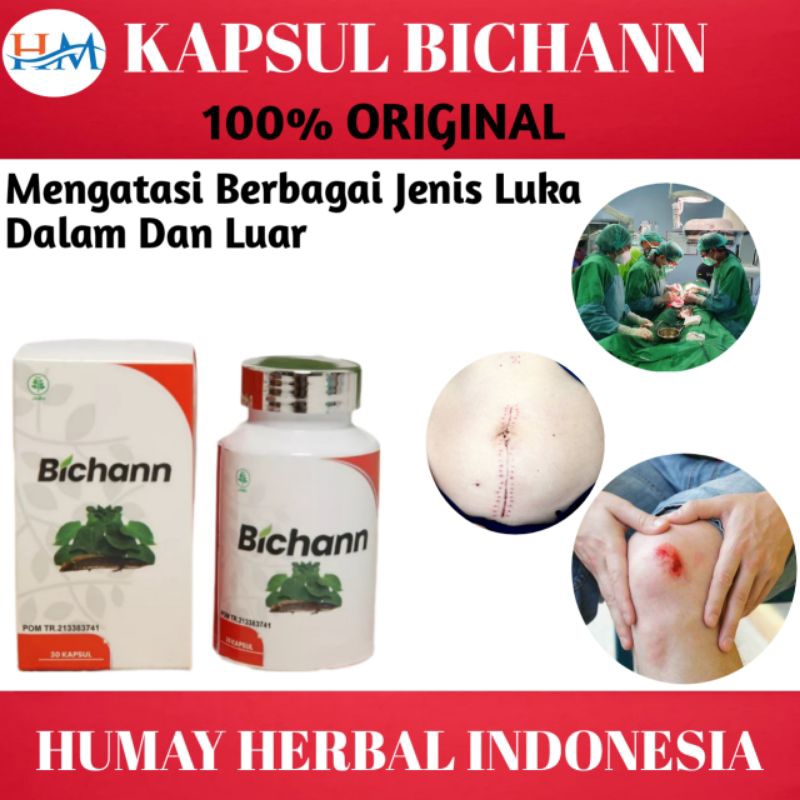 Jual Obat Luka Diabetes Basah Tradisional Kapsul Bichann Original ...