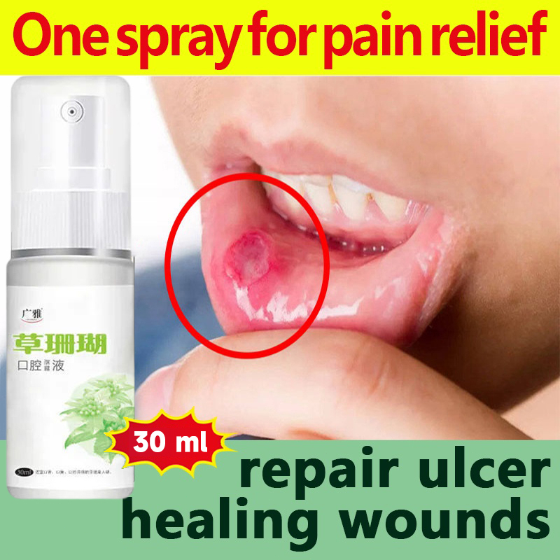 Jual Mouth spray Mouth ulcer Obat Sariawan 30ml Sore Throat Relief