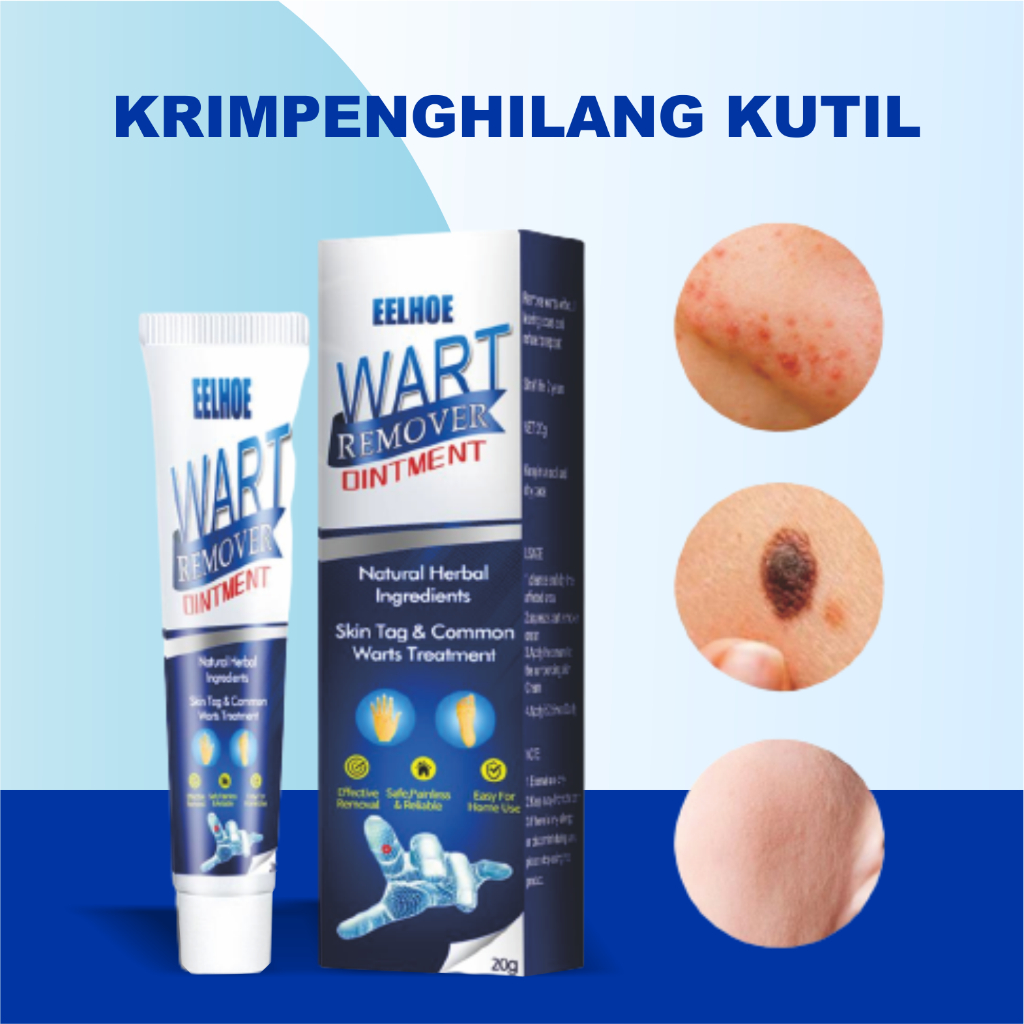 Jual Krim Penghilang Tahi Lalat Di Wajah Permanen Sumifun Wart Remover Eelhoe Wart Remover G