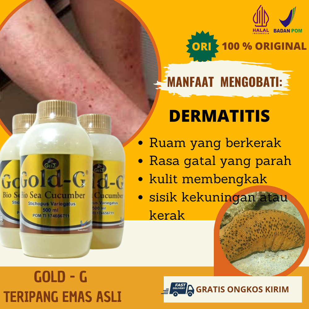 Jual Obat Atasi Penyakit Kulit Bersisik Ruam Kemerahan Kering Bernanah