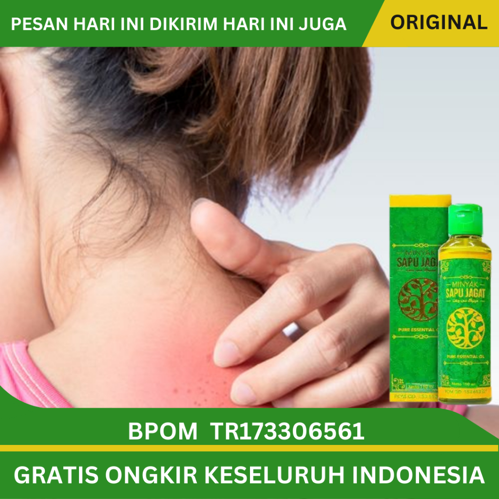 Jual Obat Biang Keringat Obat Gatal Gatal Obat Gatal Biang Keringat Obat Miliaria Rubra Obat 7858