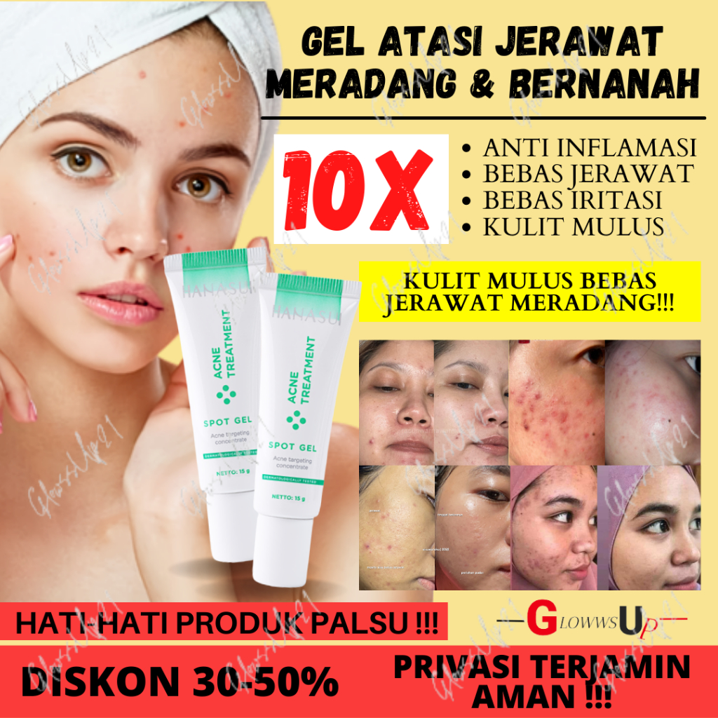 Jual HANASUI ACNE TREATMENT SPOT GEL 15GR - SPOT GEL ACNE TREATMENT