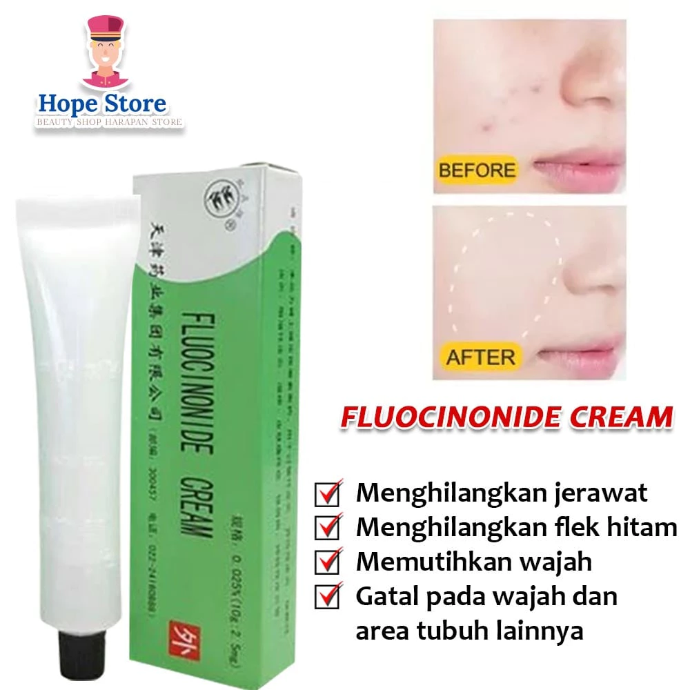 Hope Store - Salep Walet Penghilang Flek Hitam Membandel Fluocinonide Cream / Salep Gatal Kulit Paling Ampuh | AutoStock