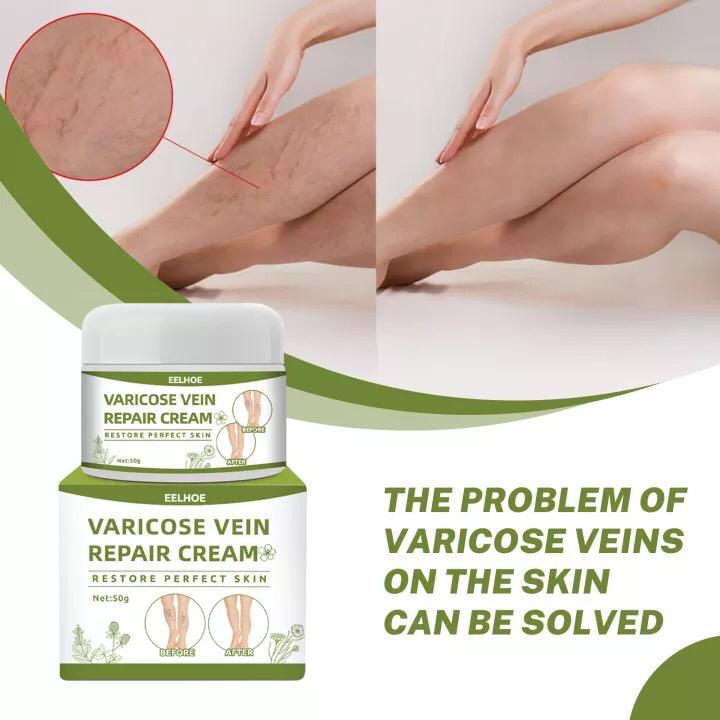 Jual EELHOE Varicose Veins Repair Cream | Cream Varises - Obat Varises ...