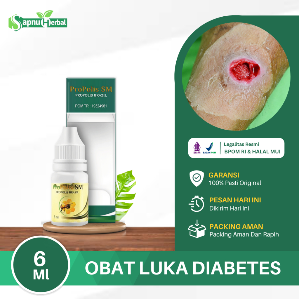 Jual Obat Luka Diabetes Agar Cepat Kering Luka Diabetes Basah Diabetes