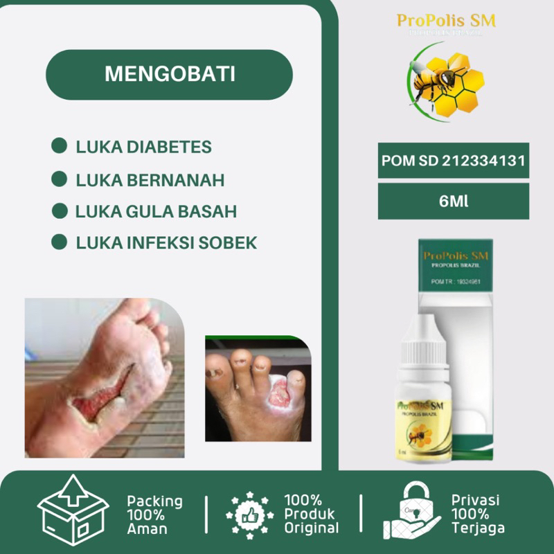 Jual Obat Tetes Luka Diabetes Obat Luka Diabetes Kering Luka Diabetes