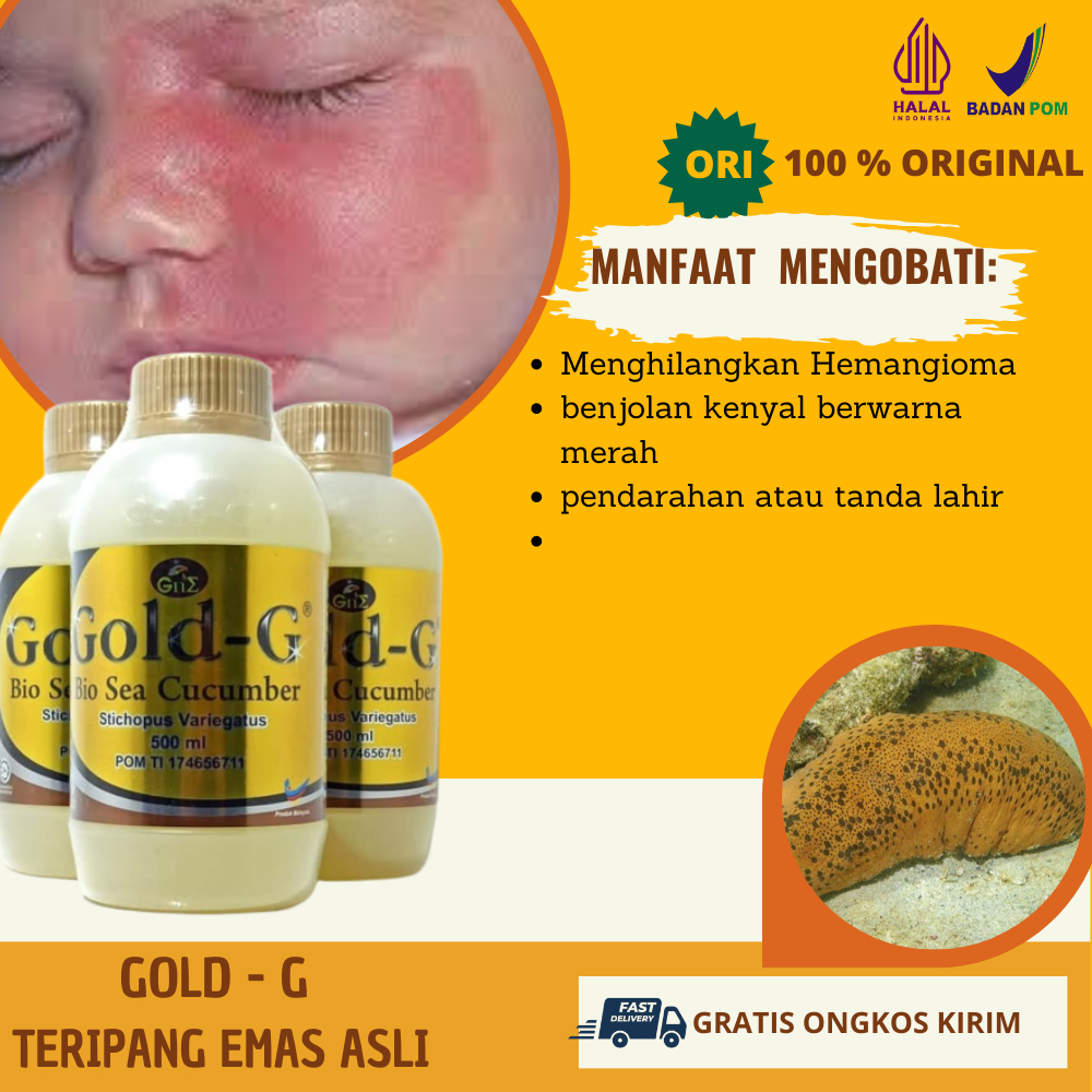 Jual Obat Herbal Menghilangkan Hemangioma, Obat Oles Alami Penghilang