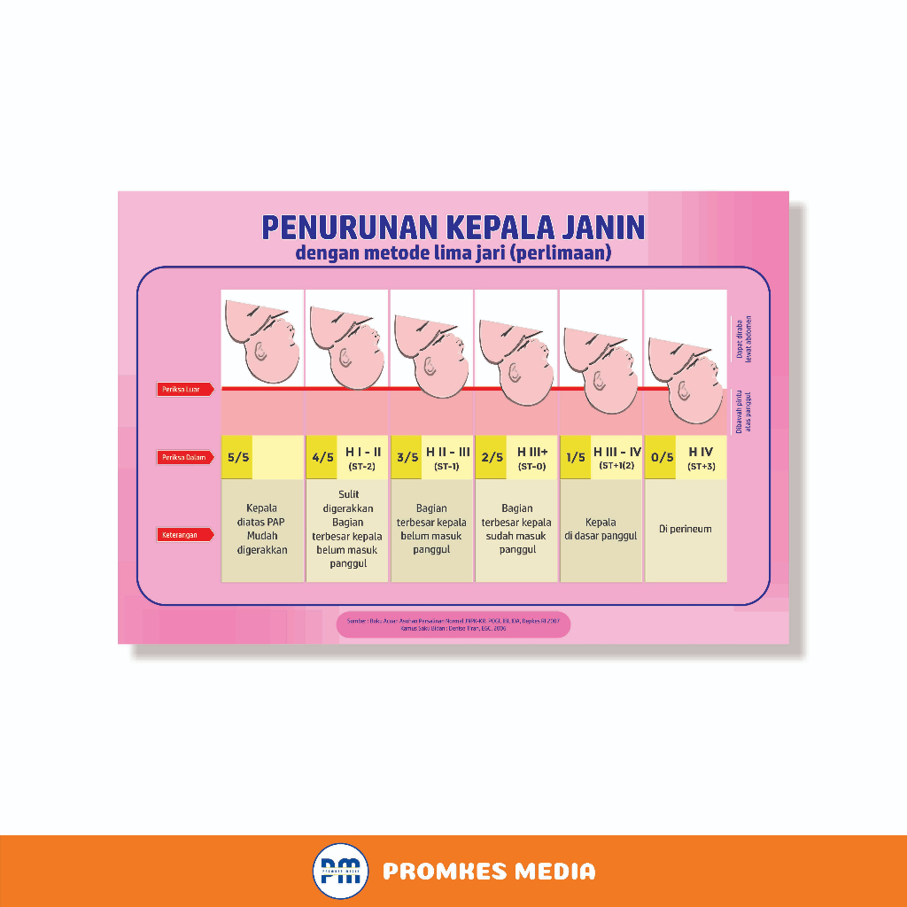 Jual Poster Kesehatan Poster Kebidanan Poster Penurunan Kepala Janin Shopee Indonesia 0591