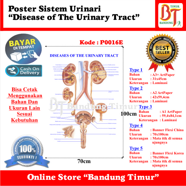 Jual POSTER SISTEM URINARI DISEASE OF THE URINARY TRACT Shopee Indonesia — free download