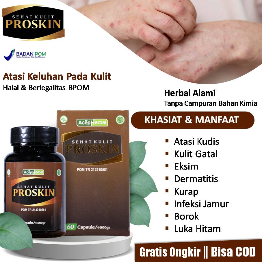 Jual Obat Kudis Kulit Gatal Eksim Dermatitis Kurap Infeksi Jamur Borok Psoriasis Kulit